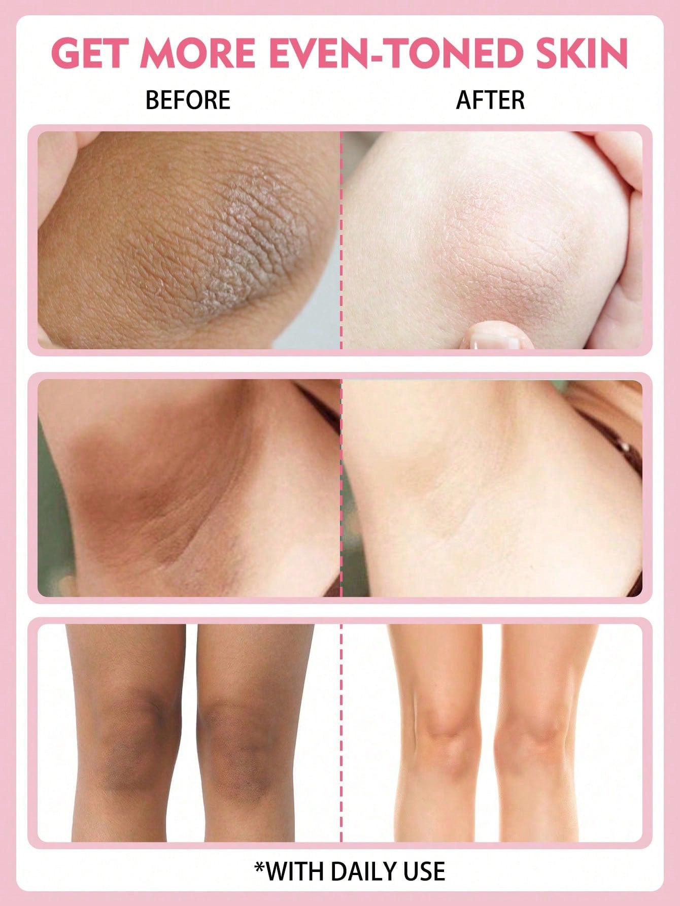 Cuisnifan Inguinal Whitening Cream | Glow Through the Body | 25g