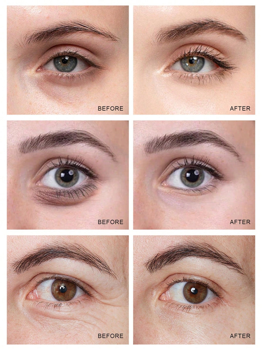 Lancôme Génifique Yeux Ultimate Dual-Repair Concentrated Eye Cream — 20ml
