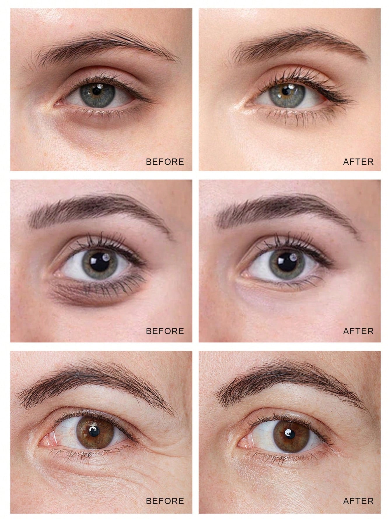 Lancôme Génifique Yeux Ultimate Dual-Repair Concentrated Eye Cream — 20ml