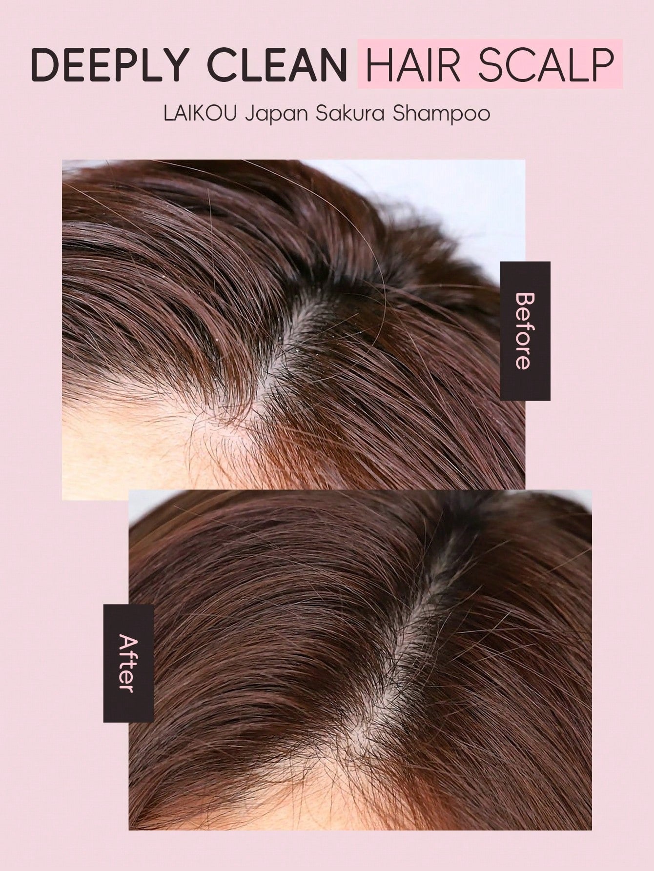 LAIKOU Japan Sakura Shampoo & Conditioner Set — Argan Oil, Shea Butter & Hyaluronic Acid | 400ml / 13.53 fl oz