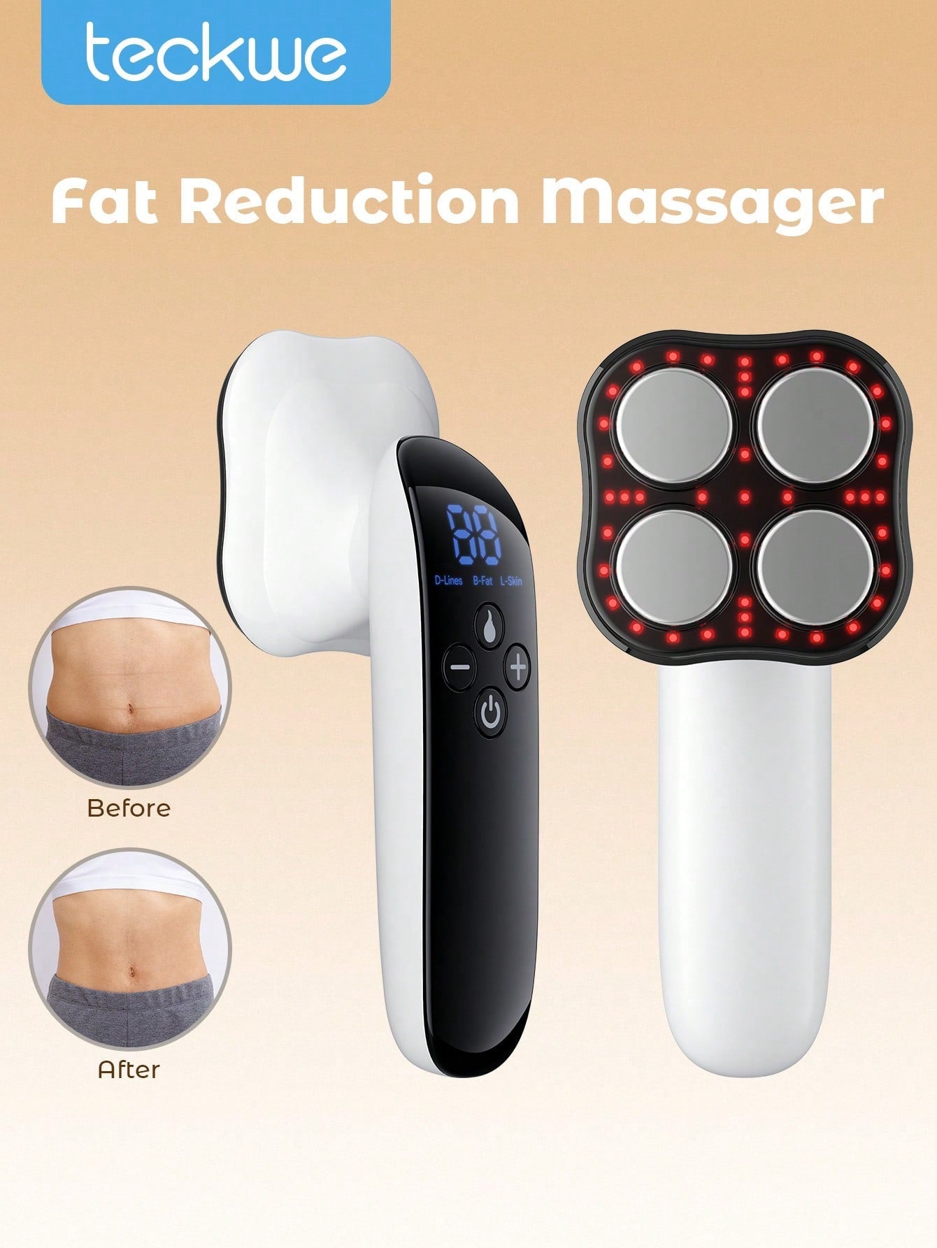 Teckwe Fat Reduction Massager | 3 Modes, 10 Gears | Dispel Lines, Burn Fat & Lift Skin | Micro Current, Radio Frequency, Infrared Ray & Fast Heating | White / Pink / Blue