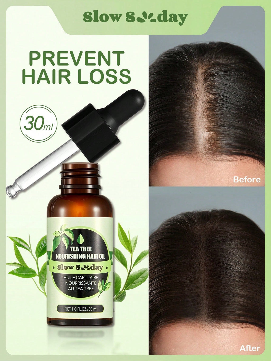 Slow 8 Day Tea Tree Nourishing Hair Oil — Prevent Hair Loss & Strengthen Roots | 30ml / 1 fl oz
