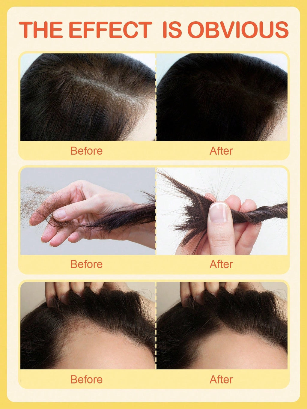 Slow 8 Day Scalp Mousse — Strengthen Hair from the Roots | Polygonum, Yeast Extract & Panax Ginseng | 50ml / 1.69 fl oz