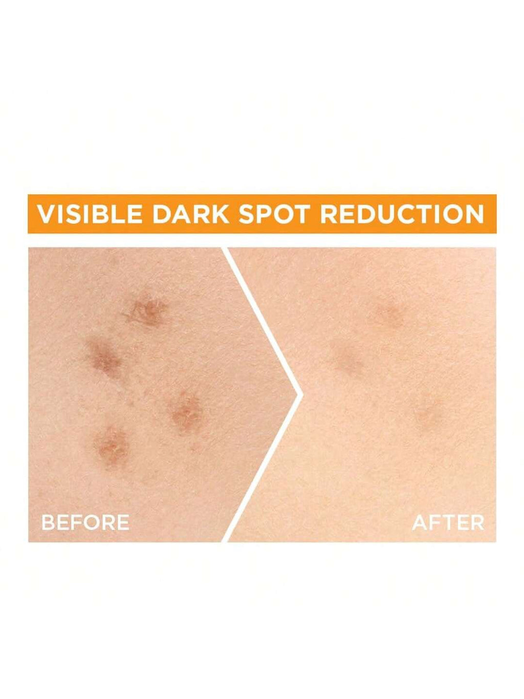 Skin Naturals Bright Complete 30x Vitamin C Booster Serum