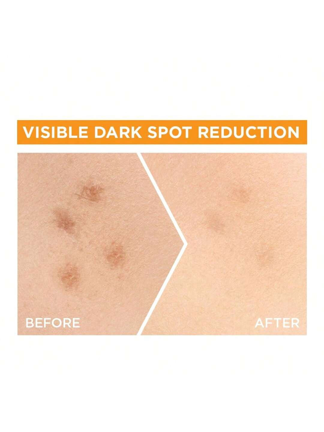 Skin Naturals Bright Complete 30x Vitamin C Booster Serum