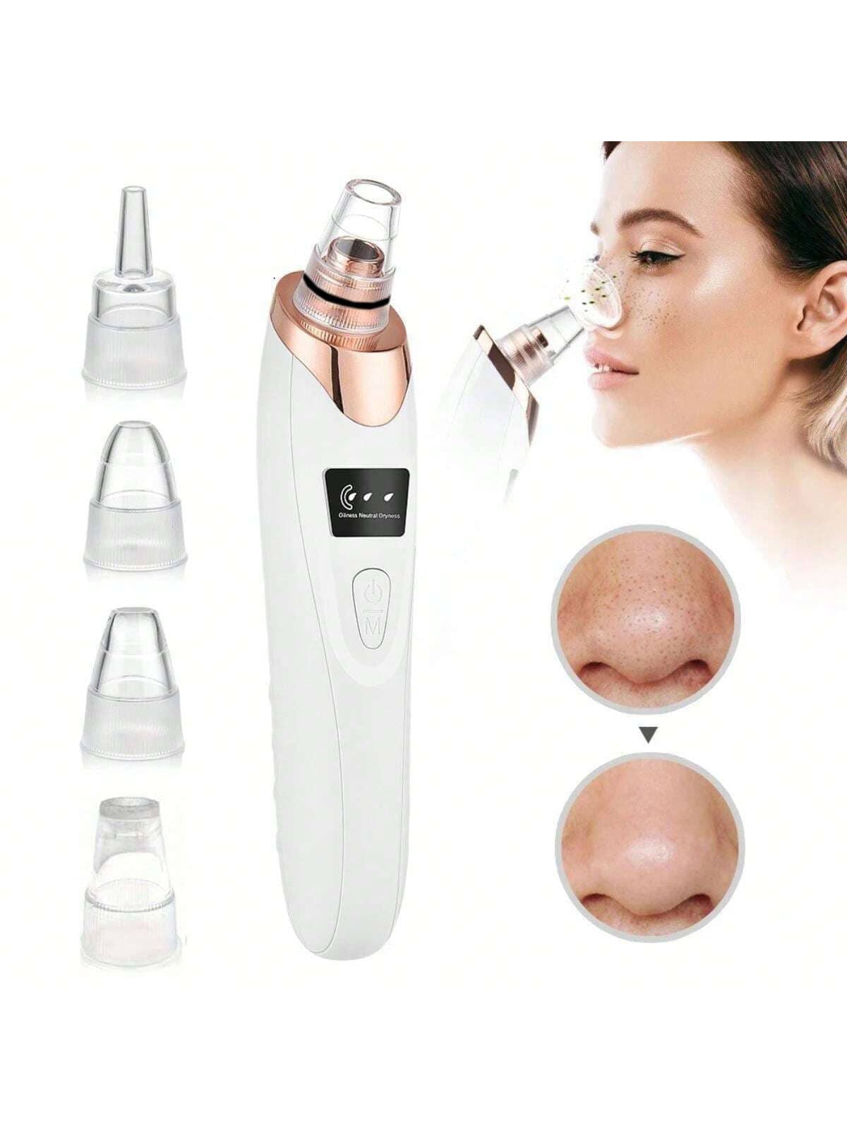 Electric Blackhead Remover Vacuum — 4-Head Pore Suction Device